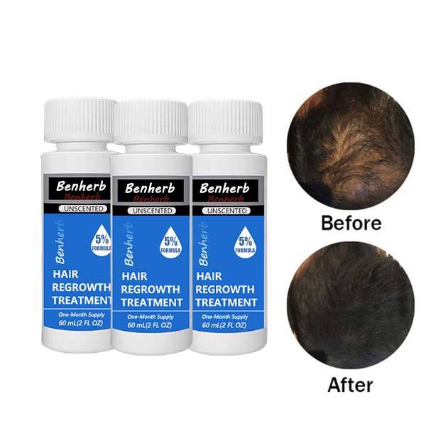 Alternative view of Kopen Organic Beard & Hair Growth Serum Kit with Derma Roller for Men